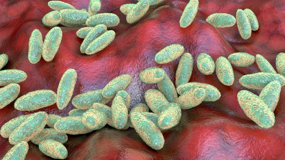 US Monitors Suspected Fatal Pneumonic Plague Case in Russia, Urges Data Transparency